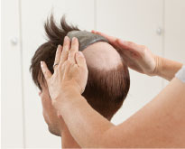 Haarteil wird schonend auf die Haarhaut gerollt