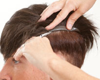 Haarsystem als Alternative zu Toupets